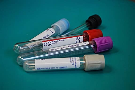 What are the duties of a traveling phlebotomist?